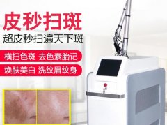 賽諾秀蜂窩皮秒機器多少錢一臺？755超皮秒機器設備價格報價
