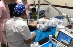疤痕治療儀器多少錢一臺？點陣激光設備價格_二氧化碳點陣激光儀器