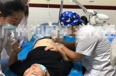 點陣激光設備哪個牌子好？國產點陣激光儀器_co2點陣激光治療儀品牌