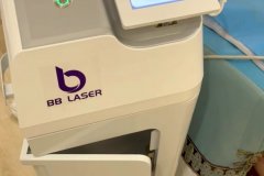 BB laser素顏光國內哪個生產廠家比較好？進口素顏光設備代理商